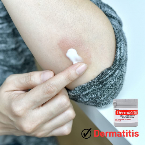 Дермокрем 4,4 унции. (125G)