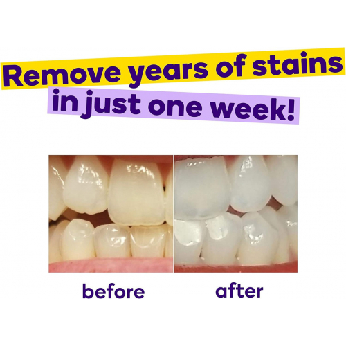 Полоски для отбеливания зубов burst