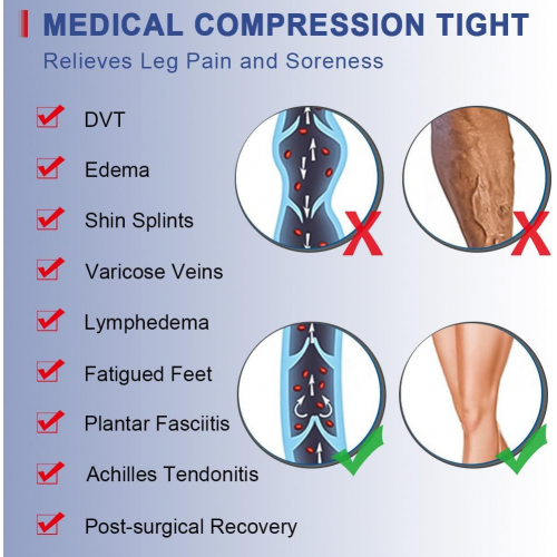 Медицинские компрессионные колготки Beister для женщин и мужчин