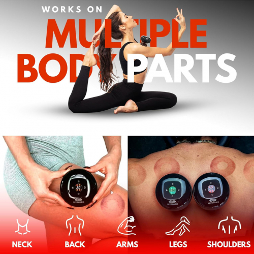 REVO Оригинальный интеллектуальный массажер для баночной терапии 4 в 1