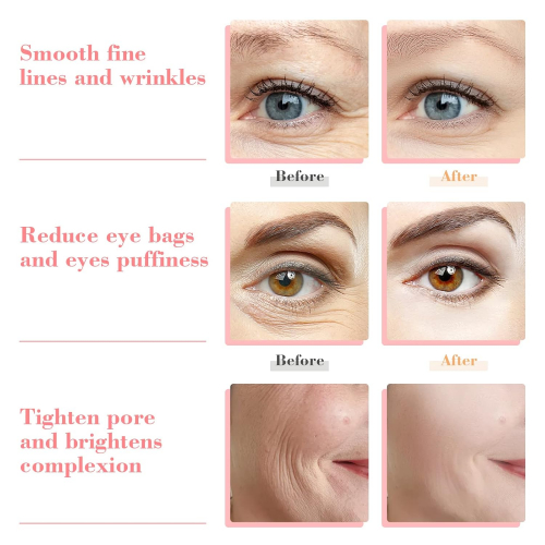 Slashome — Массажер и Охлаждающий Инструмент для Красоты